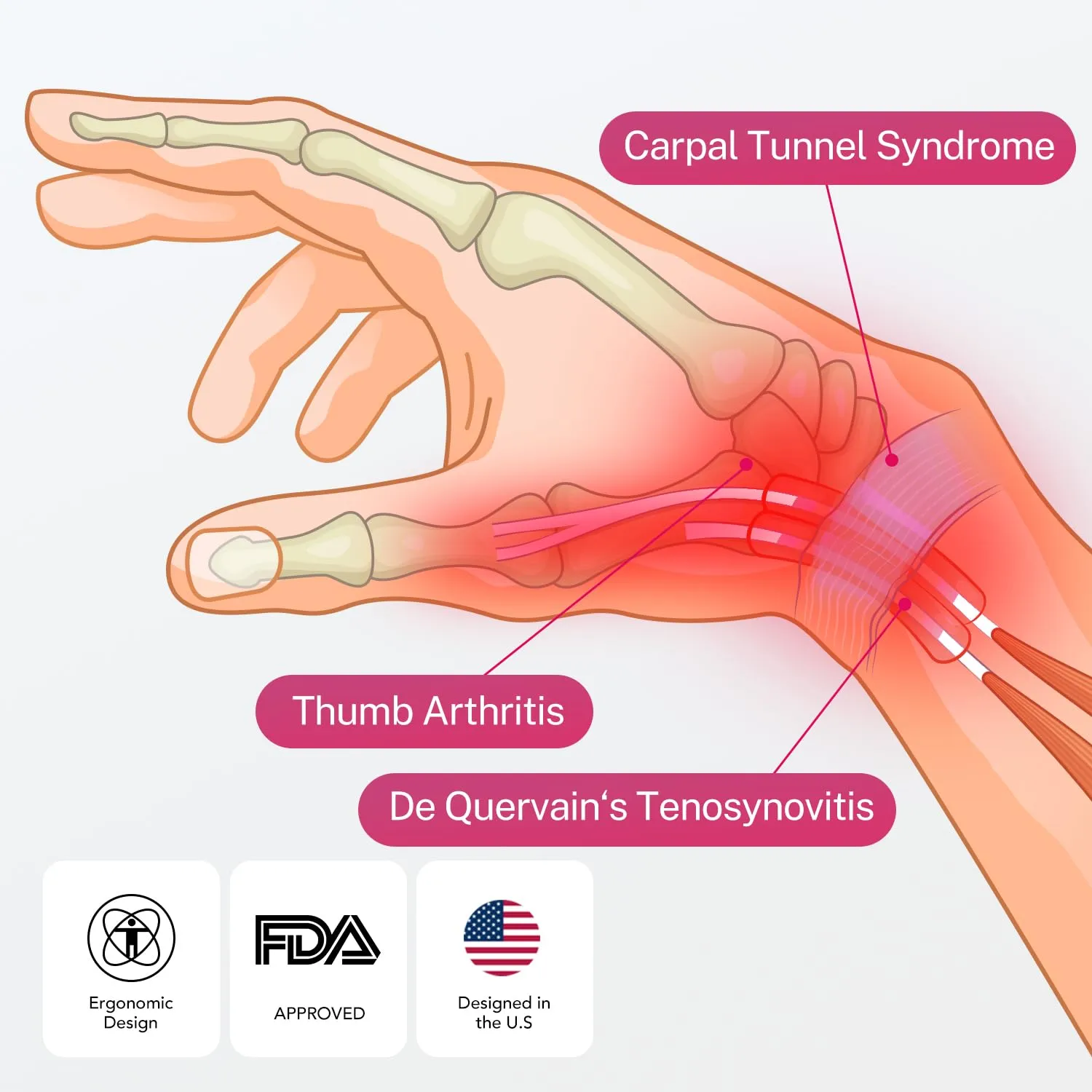 Wrist Brace & Thumb Stabilizer, Carpal Tunnel, De Quervain's Tenosynovitis, Tendonitis, Arthritis Support, Thumb Splint for Pain Relief, Women and Men (Right Hand, L/XL)